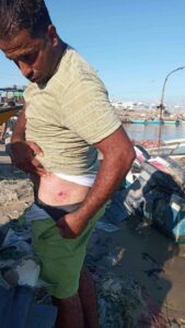 Israeli Navy Shoots, Injures a Palestinian Fisherman off the Gaza Coast