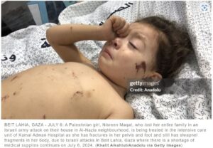 US medics: Gaza’s children are “maimed and mutilated by our weapons”