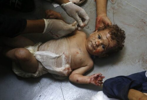 Injured baby in Jabalia -- image from Wafa news