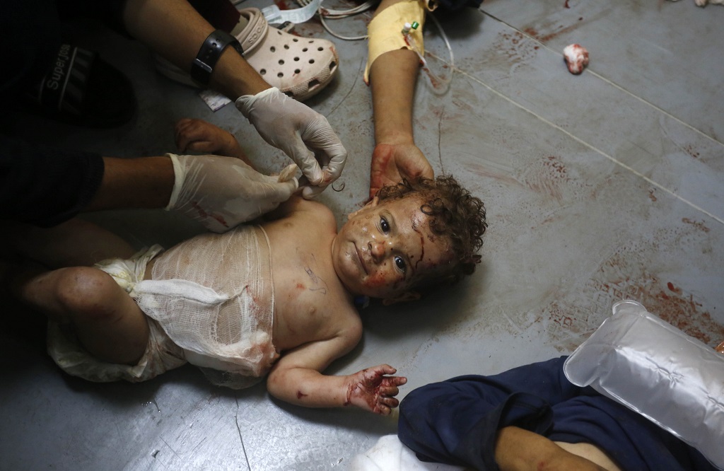 Injured baby in Jabalia -- image from Wafa news