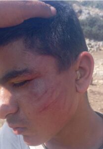 Soldiers Assault One, Settlers Assault a Woman and a Child, in the West Bank