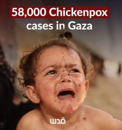 Gaza hospitals treat five wounded, receive body of one dead
